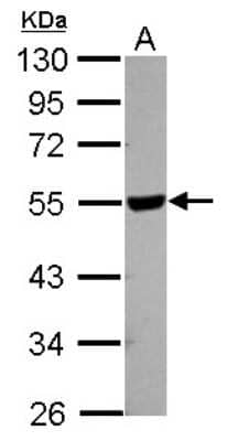 Western Blot: HYAL2 Antibody [NBP2-21609]