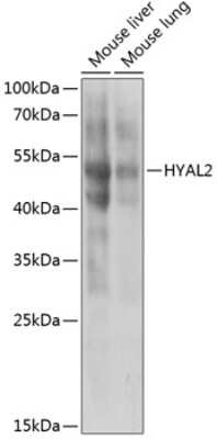 Western Blot: HYAL2 AntibodyBSA Free [NBP3-04995]