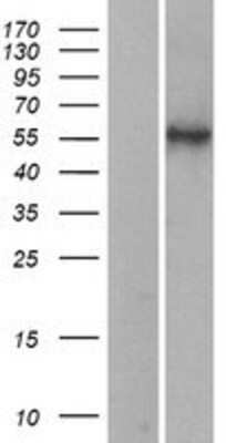 Western Blot: HYAL2 Overexpression Lysate [NBL1-11794]