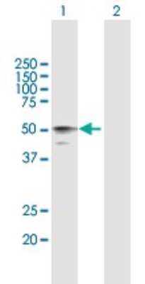 Western Blot: HYAL3 Antibody [H00008372-B01P]