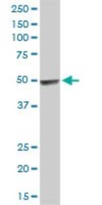 Western Blot: HYAL3 Antibody [H00008372-D01P]