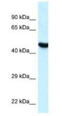 Western Blot: HYAL3 Antibody [NBP1-79911]