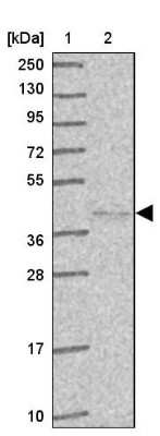 Western Blot: HYAL3 Antibody [NBP2-14112]