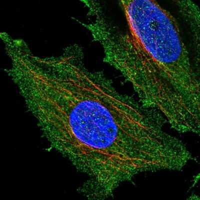 Immunocytochemistry/ Immunofluorescence: HYDIN1 Antibody [NBP2-56377]