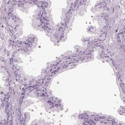 Immunohistochemistry-Paraffin: HYDIN1 Antibody [NBP2-57868]