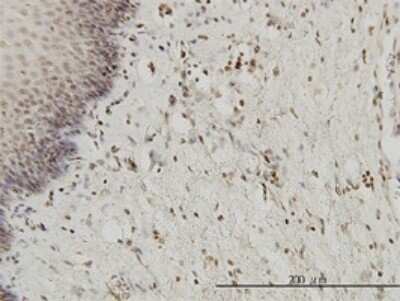 Immunohistochemistry-Paraffin: HYI Antibody (2A2) [H00081888-M01]