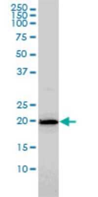 Western Blot: HYI Antibody (2F6) [H00081888-M02]