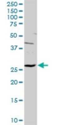 Western Blot: HYI Antibody [H00081888-D01P]