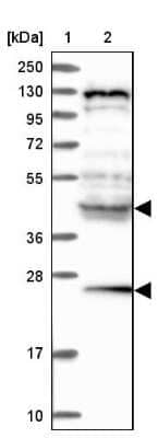 Western Blot: HYI Antibody [NBP1-81659]