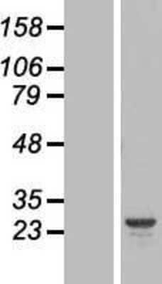 Western Blot: HYI Overexpression Lysate [NBL1-11796]