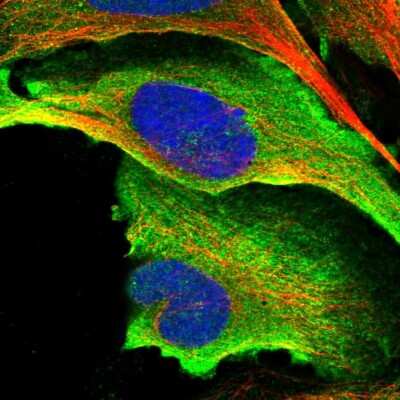 Immunocytochemistry/ Immunofluorescence: HYLS1 Antibody [NBP1-83513]