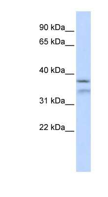 Western Blot: HYLS1 Antibody [NBP1-56899]