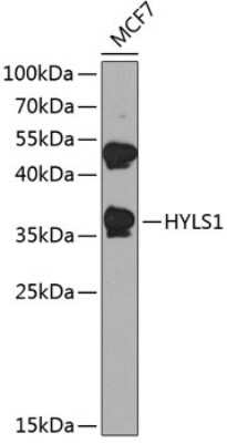 Western Blot: HYLS1 AntibodyBSA Free [NBP3-05148]