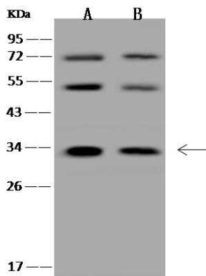 Western Blot: HYLS1 Antibody [NBP3-12710]