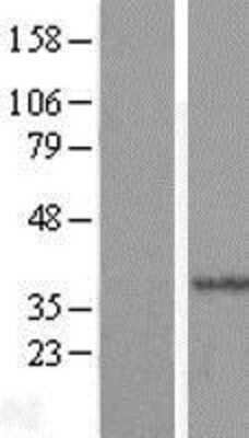 Western Blot: HYLS1 Overexpression Lysate [NBL1-11797]