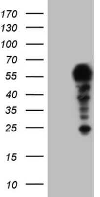 Western Blot: HYPB Antibody (OTI1E1) [NBP2-45791]