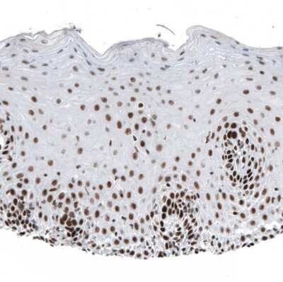 Immunohistochemistry-Paraffin: HYPB Antibody (CL9956) [NBP2-88941]