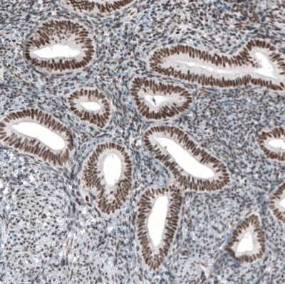 Immunohistochemistry-Paraffin: HYPB Antibody (CL9956) [NBP2-88941]