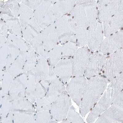 Immunohistochemistry-Paraffin: HYPB Antibody (CL9956) [NBP2-88941]