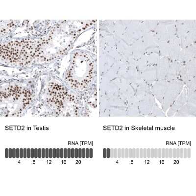 Immunohistochemistry-Paraffin: HYPB Antibody (CL9956) [NBP2-88941]