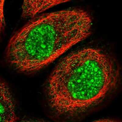 Immunocytochemistry/ Immunofluorescence: HYPB Antibody [NBP1-89843]