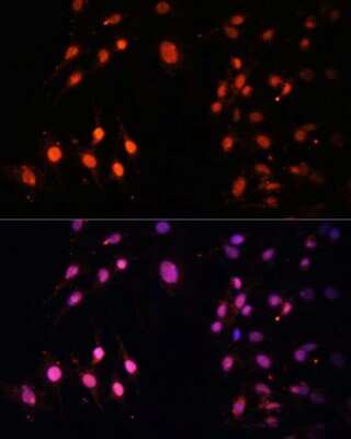 Immunocytochemistry/ Immunofluorescence: HYPB Antibody - Azide and BSA Free [NBP3-03807]