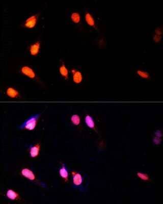 Immunocytochemistry/ Immunofluorescence: HYPB Antibody - Azide and BSA Free [NBP3-03807]