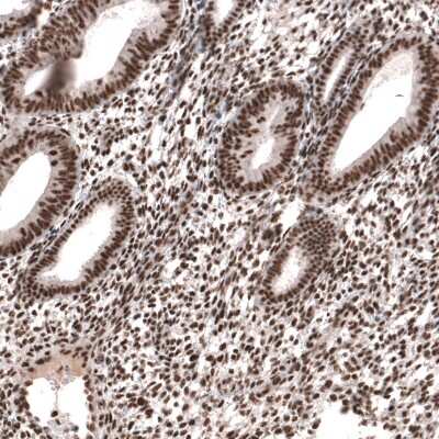 Immunohistochemistry-Paraffin: HYPB Antibody [NBP1-89843]