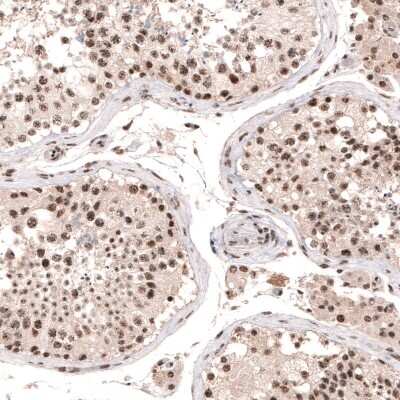 Immunohistochemistry-Paraffin: HYPB Antibody [NBP1-89843]