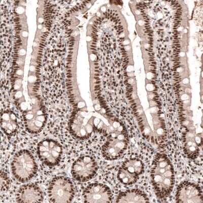 Immunohistochemistry-Paraffin: HYPB Antibody [NBP1-89843]