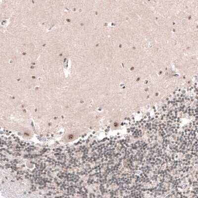 Immunohistochemistry-Paraffin: HYPB Antibody [NBP1-89843]