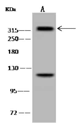 Western Blot: HYPB Antibody [NBP2-98651]