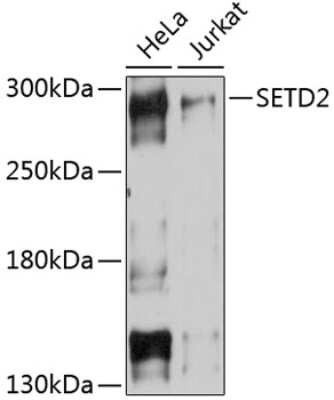 Western Blot: HYPB AntibodyAzide and BSA Free [NBP3-03806]