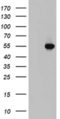 Western Blot: HYPE Antibody (OTI2A11) [NBP2-45664]