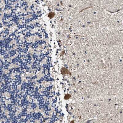 Immunohistochemistry-Paraffin: HYPE Antibody [NBP1-89697]