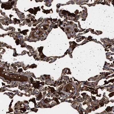 Immunohistochemistry-Paraffin: HYPE Antibody [NBP1-89697]