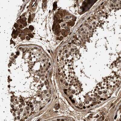 Immunohistochemistry-Paraffin: HYPE Antibody [NBP1-89697]