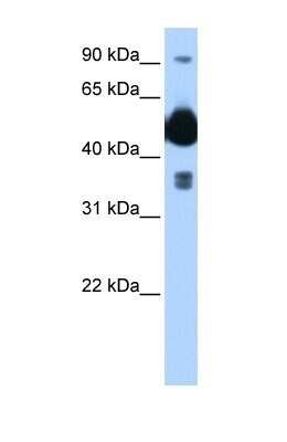 Western Blot: HYPE Antibody [NBP1-58290]