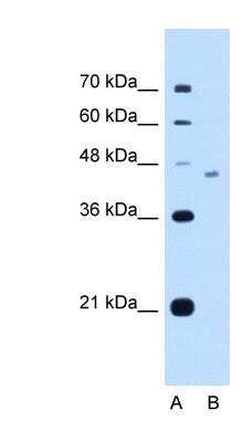 Western Blot: HYPE Antibody [NBP1-58294]