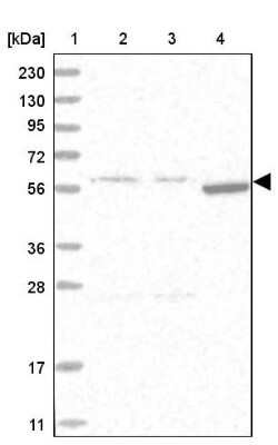 Western Blot: HYPE Antibody [NBP1-89697]