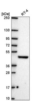 Western Blot: HYPE Antibody [NBP2-58855]