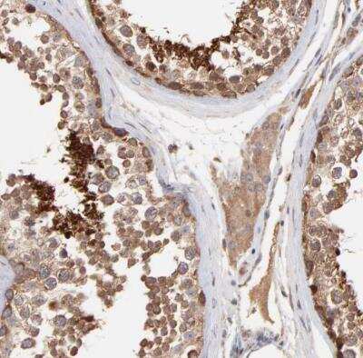 Immunohistochemistry-Paraffin: HYPM Antibody [NBP1-81747]