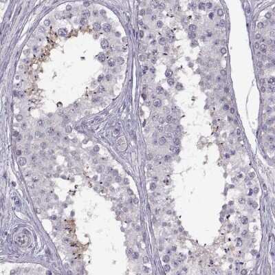 Immunohistochemistry-Paraffin: HYPM Antibody [NBP1-81747]