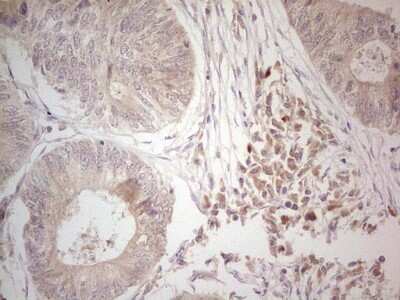 Immunohistochemistry: Hairless Antibody (OTI1D9) [NBP2-46004]