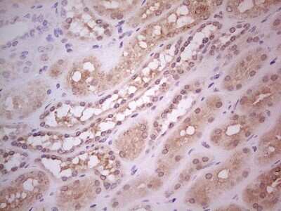 Immunohistochemistry: Hairless Antibody (OTI1D9) [NBP2-46004]