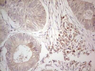 Immunohistochemistry: Hairless Antibody (OTI1D9) - Azide and BSA Free [NBP2-72023]