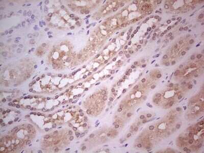 Immunohistochemistry: Hairless Antibody (OTI1D9) - Azide and BSA Free [NBP2-72023]