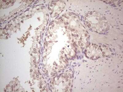 Immunohistochemistry: Hairless Antibody (OTI1D9) - Azide and BSA Free [NBP2-72023]