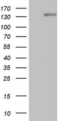 Western Blot: Hairless Antibody (OTI1D9)Azide and BSA Free [NBP2-72023]