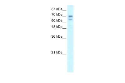 Western Blot: Hairless Antibody [NBP2-87553]